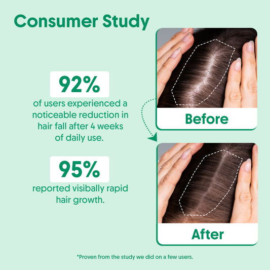 Rosemary Hair Growth Serum For Stronger, Healthier Hair - 30ml