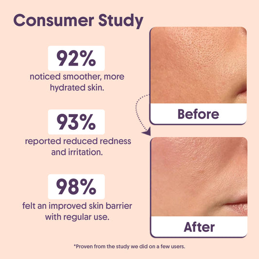 Advanced Barrier Repair Moisturizer For Deep Hydration - 100g