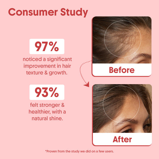 Batana Hair Oil For Hair Growth For Healthy, Strong Hair - 200ml