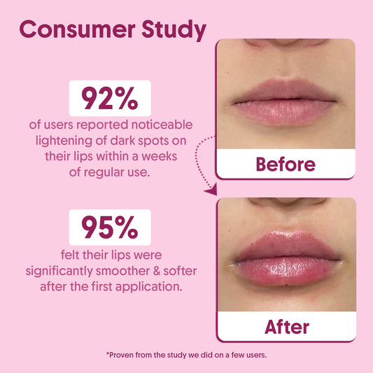 Beetroot Lip Scrub For Exfoliation, Lips Brightening & Softness - 15g