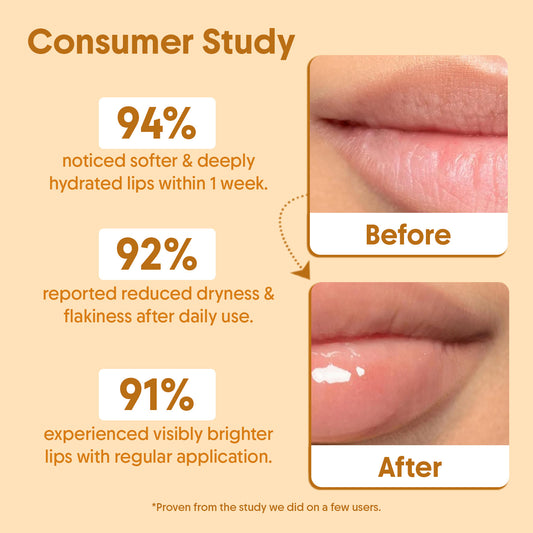 Lip Balm Combo - With SPF 50+++ For Lip Brightening