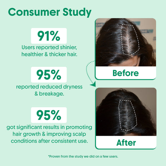 Rosemary Water Spray & Hair Growth Serum Combo