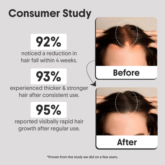 Advanced Hair Growth Serum with 3% Redensyl, 2% Anagain, 2% Procapil - 30ml