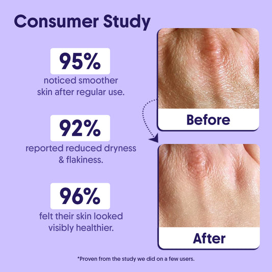 10% AHA + 1% BHA Body Lotion For Exfoliation - 200ml