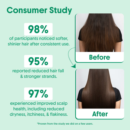 Rosemary Shampoo For Anti Hair Fall & Hair Growth - 200ml