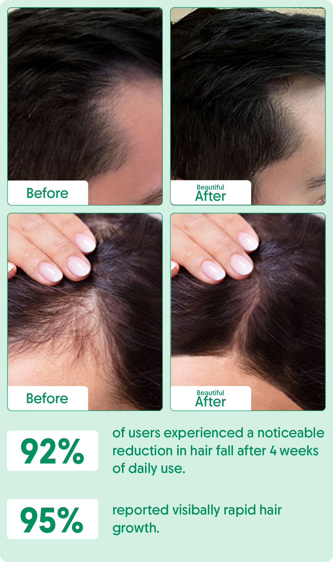 Rosemary Hair Growth Serum For Stronger, Healthier Hair - 30ml
