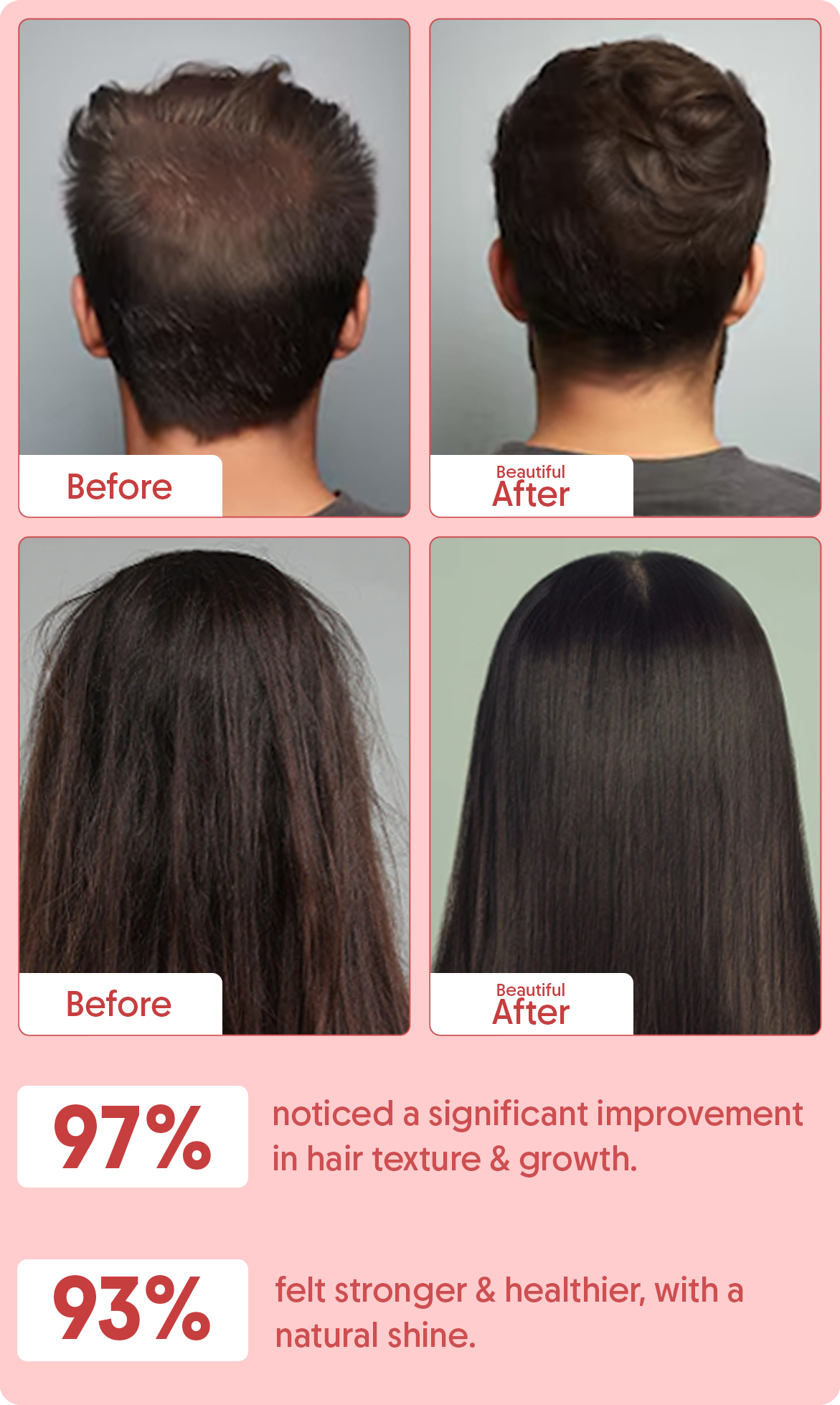 Batana Hair Oil For Hair Growth For Healthy, Strong Hair - 200ml