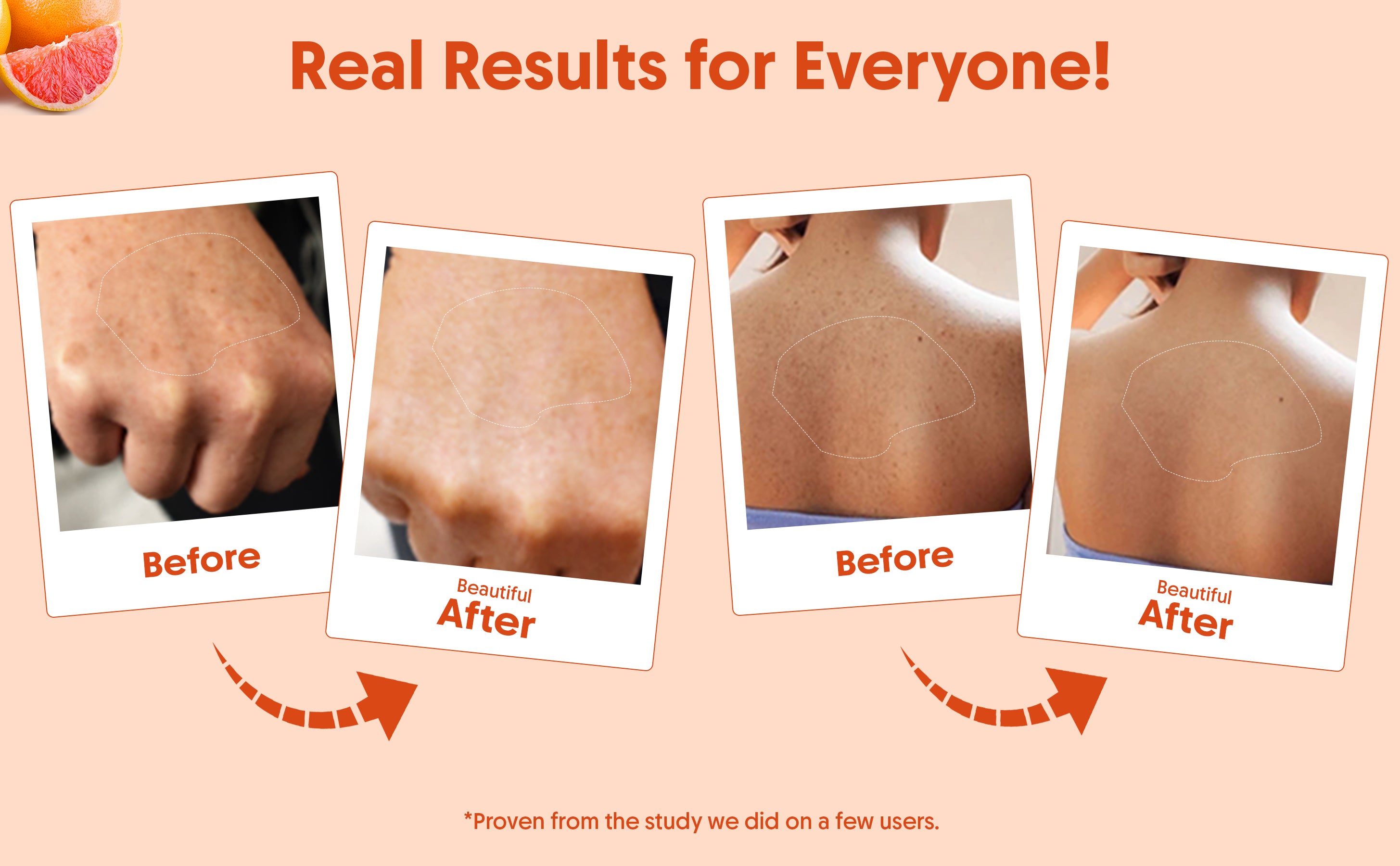 When to Apply Sunscreen? Timing It Right forMaxProtection