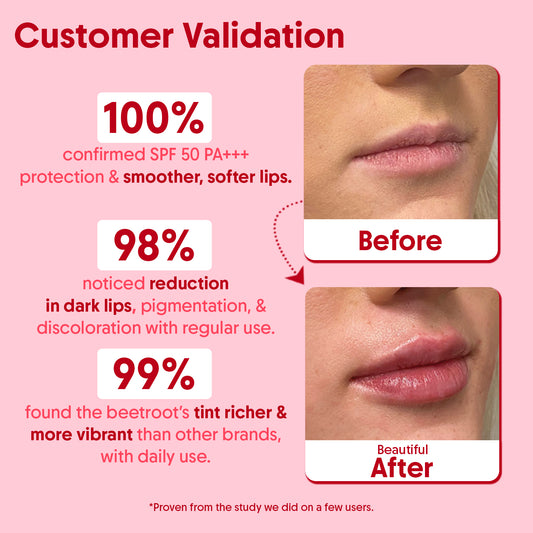 Tinted Beetroot Lip Balm With SPF 50 PA+++ For Lip Brightening - 5g