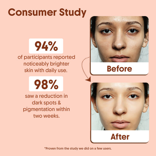 Vitamin C Seum And Vitamin E Oil For Face Brightening