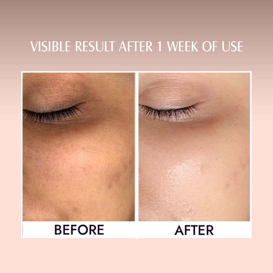 Vitamin E Face Oil For Skin Repair & Radiant Glow - 30ml